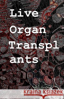 Live Organ Transplants Gabe Gott 9781541222021