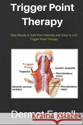 Trigger Point Therapy: Stop Muscle & Joint Pain Naturally with Easy to use Trigger Point Therapy Farrell, Dermot 9781543201307 Createspace Independent Publishing Platform