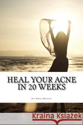 Heal your acne in 20 weeks: Everyday skin care plan Novotna, Nikola 9781543235876