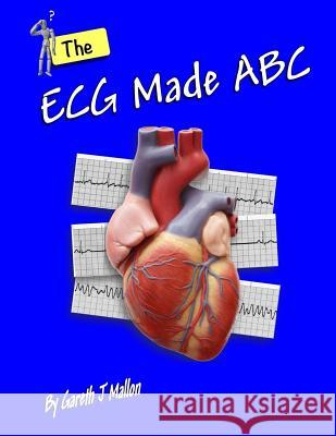 The ECG Made ABC Gareth J Mallon 9781544600178 Createspace Independent Publishing Platform