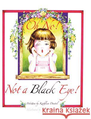 Oh No! Not a Black Eye! Kathleen Dautel 9781545671825