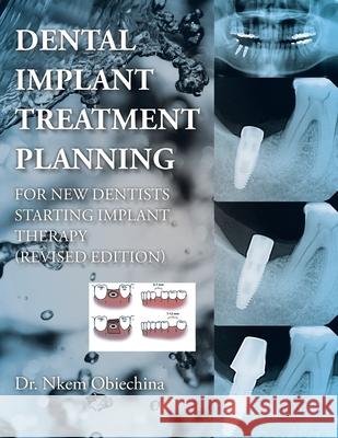 Dental Implant Treatment Planning for New Dentists Starting Implant Therapy Dr Nkem Obiechina 9781546221111 Authorhouse