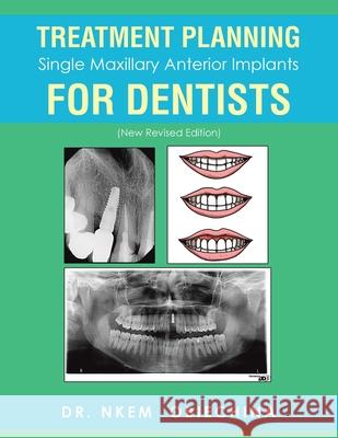 Treatment Planning Single Maxillary Anterior Implants for Dentists Dr Nkem Obiechina 9781546242789 Authorhouse