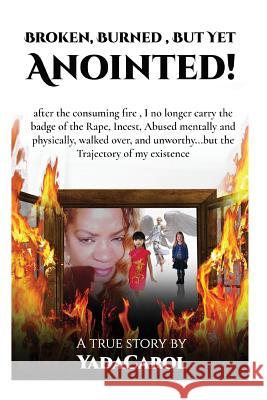 Broken Burned, But Yet Anointed!: A product of Incest, Sexual, physically and mentally Abused, homeless but with Trajectory in life.I survived! Spirit, The Holy 9781546712688 Createspace Independent Publishing Platform