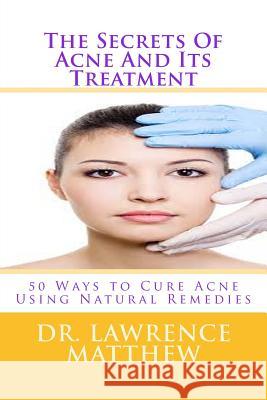 The Secrets of Acne and Its Treatment: 50 Ways to Cure Acne Using Natural Remedies Dr Lawrence Matthew 9781547212149