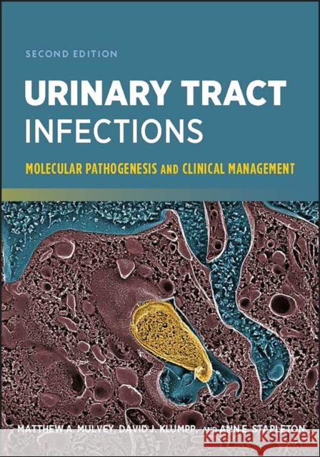 Urinary Tract Infections: Molecular Pathogenesis and Clinical Management Mulvey, Matthew A. 9781555817398 ASM Press