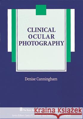 Clinical Ocular Photography Denise Cunningham   9781556423772 SLACK  Incorporated