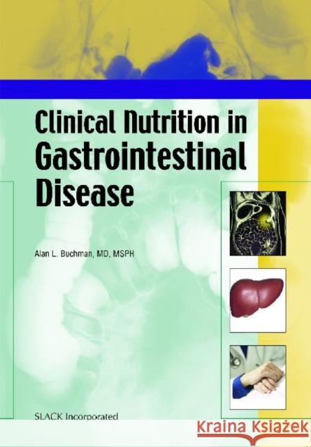 Clinical Nutrition in Gastrointestinal Disease Alan Buchman 9781556426971 Slack