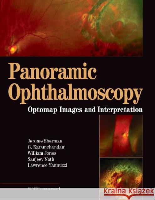 Panoramic Ophthalmoscopy: Optomap Images and Interpretation Sherman, Jerry 9781556427800 Slack