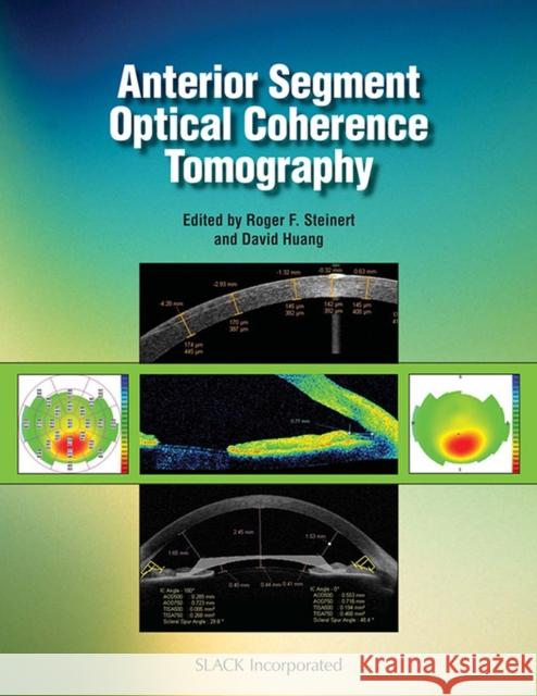 Anterior Segment Optical Coherence Tomography David Huang Roger Steinert 9781556428081