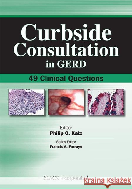 Curbside Consultation in GERD: 49 Clinical Questions Katz, Philip 9781556428180 Slack