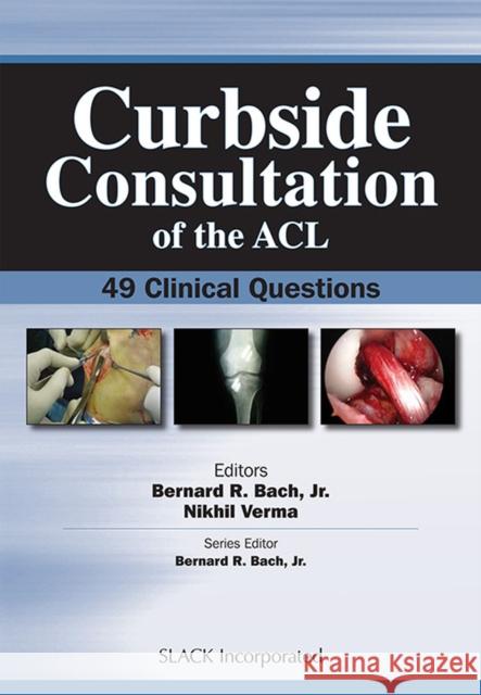 Curbside Consultation of the ACL: 49 Clinical Questions Bach, Bernard 9781556428258 Slack