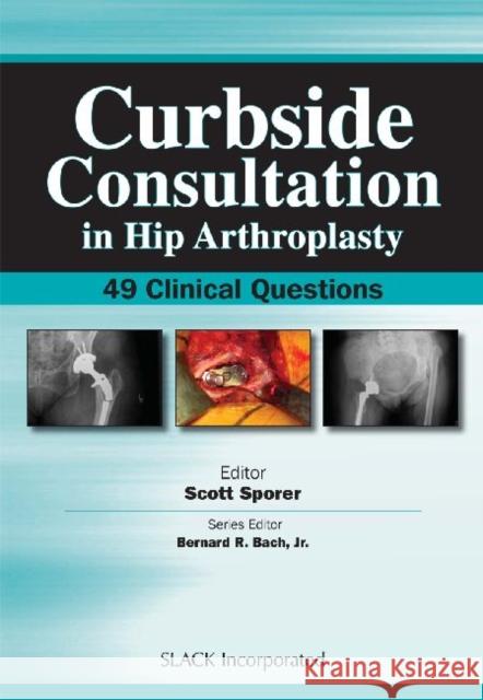 Curbside Consultation in Hip Arthroplasty: 49 Clinical Questions Sporer, Scott 9781556428302 Slack