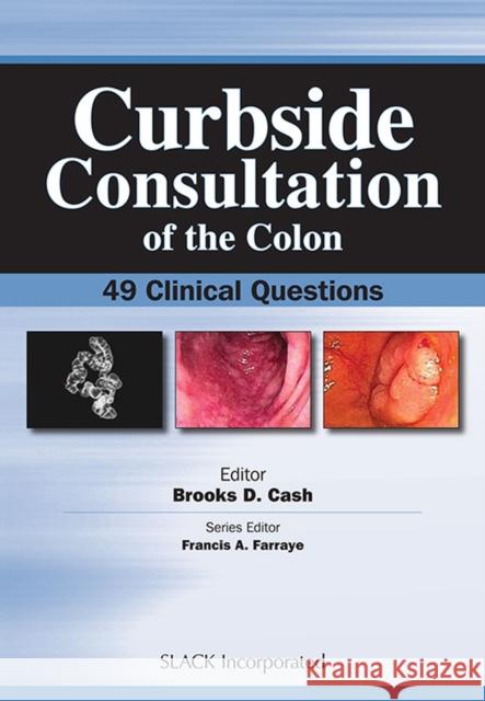 Curbside Consultation of the Colon: 49 Clinical Questions Cash, Brookes D. 9781556428319 Slack