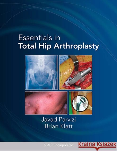 Essentials in Total Hip Arthroplasty Javad Parvizi Benjamin Bender J. Parvizi 9781556428708 Slack