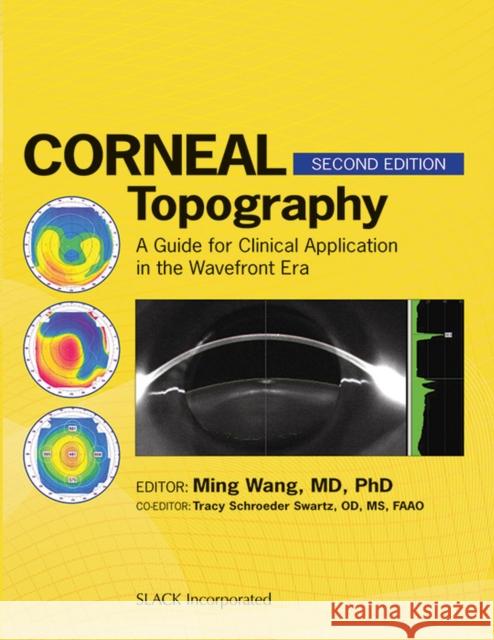 Corneal Topography: A Guide for Clinical Application in the Wavefront Era Wang, Ming 9781556429705
