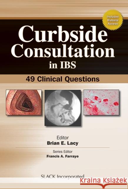 Curbside Consultation in IBS: 49 Clinical Questions Lacy, Brian E. 9781556429859 Slack