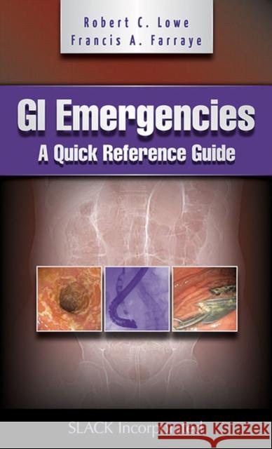 GI Emergencies: A Quick Reference Guide Lowe, Robert C. 9781556429903
