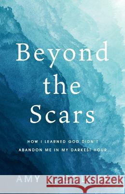 Beyond the Scars: How I Learned God Didn't Abandoned Me in My Darkest Hour Amy K 9781563096198 Iron Stream