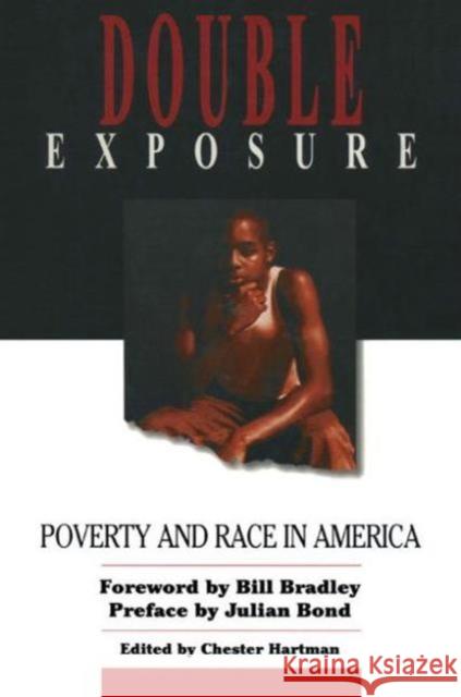 Double Exposure: Poverty and Race in America Hartman, Jean M. 9781563249617 M.E. Sharpe