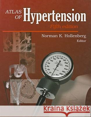 Atlas of Hypertension Norman K. Hollenberg 9781573402200 Current Medicine