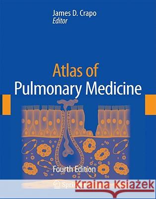 Atlas of Pulmonary Medicine James D. Crapo W. Langenfeld M. Looney 9781573402934 CMG