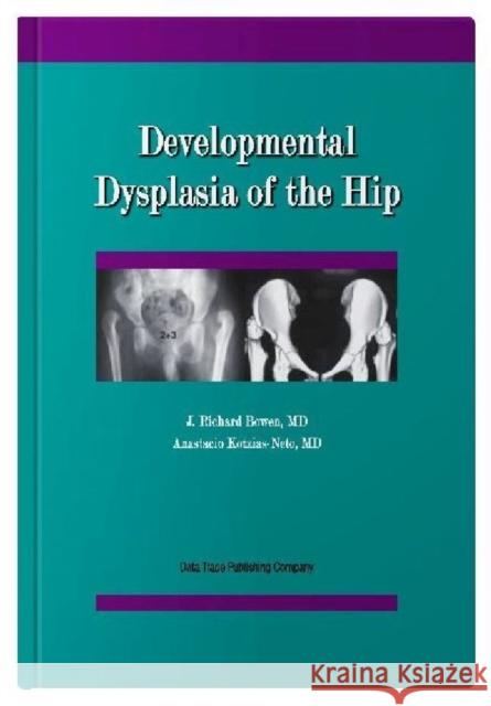 Developmental Dysplasia of the Hip J.Richard Bowen Anastacio Kotzias-Neto  9781574001082