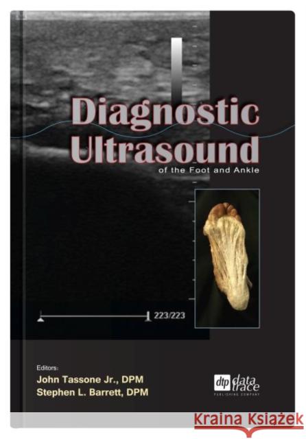 Diagnostic Ultrasound of the Foot and Ankle John Tassone Stephen Barrett  9781574001426 Data Trace Publishing Company
