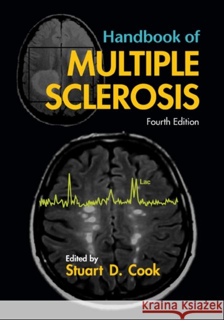 Handbook of Multiple Sclerosis Stuart D. Cook 9781574448276