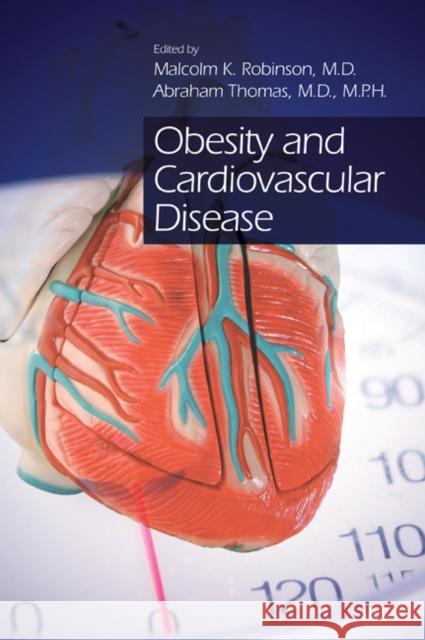 Obesity and Cardiovascular Disease Malcolm K Robinson 9781574448634