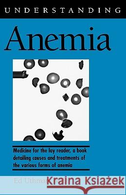 Understanding Anemia Ed Uthman 9781578060399