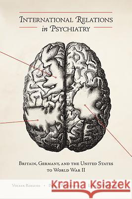 International Relations in Psychiatry: Britain, Germany, and the United States to World War II Volker Roelcke Paul Weindling Louise Westwood 9781580463393 University of Rochester Press