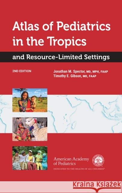 Atlas of Pediatrics in the Tropics and Resource-Limited Settings Jonathan M. Spector Timothy E. Gibson 9781581109603 American Academy of Pediatrics