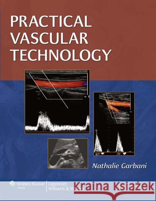 Practical Vascular Technology: A Comprehensive Laboratory Text Garbani, Nathalie 9781582558097 0