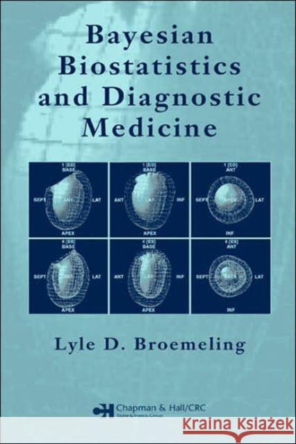 Bayesian Biostatistics and Diagnostic Medicine Lyle D. Broemeling 9781584887676 Chapman & Hall/CRC