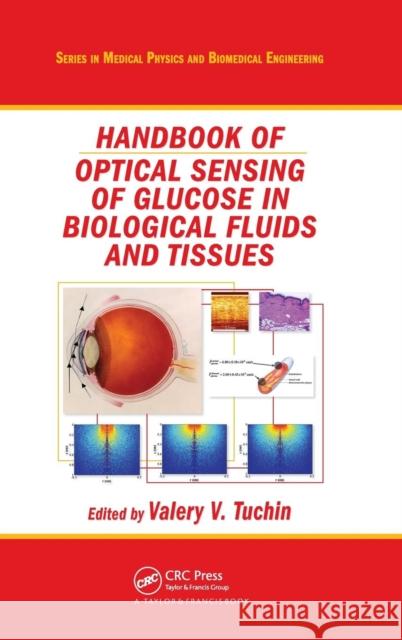 Handbook of Optical Sensing of Glucose in Biological Fluids and Tissues Valery V. Tuchin Valery V. Tuchin 9781584889748 Taylor & Francis