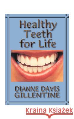 Healthy Teeth for Life Dianne Davis Gillentine 9781585000043 Authorhouse