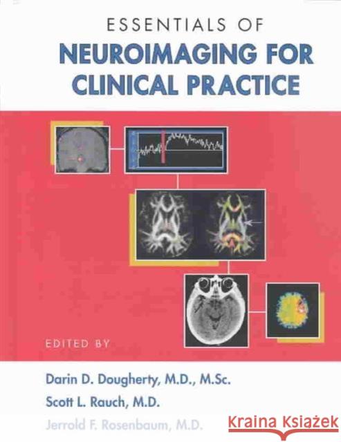 Essentials of Neuroimaging for Clinical Practice Darin D. Dougherty Scott L. Rauch Jerrold F. Rosenbaum 9781585620791 American Psychiatric Publishing, Inc.