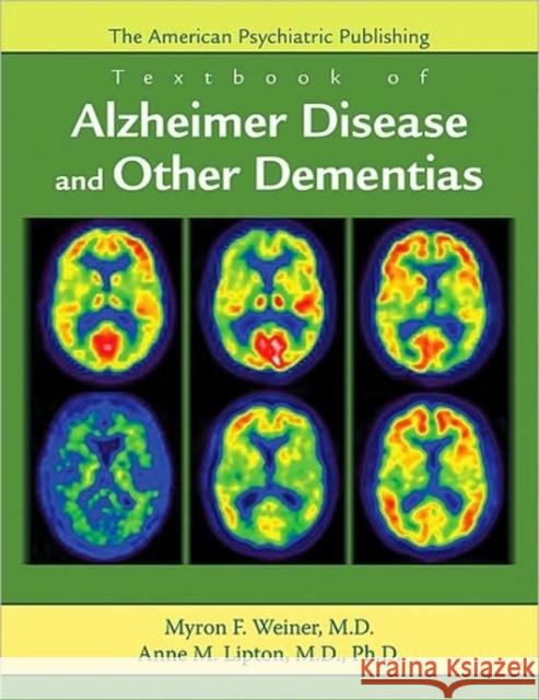 App Textbk Alzheimers & Other Dementias Weiner, Myron F. 9781585622788