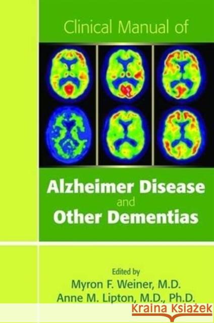 Clinical Manual of Alzheimer Disease and Other Dementias Myron Weiner 9781585624225