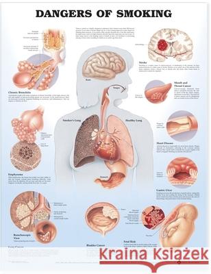 Dangers of Smoking Anatomical Chart  Anatomical Chart Company 9781587792311 0