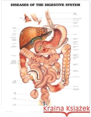 Diseases of the Digestive System Anatomical Chart  Anatomical Chart Company 9781587792366 0