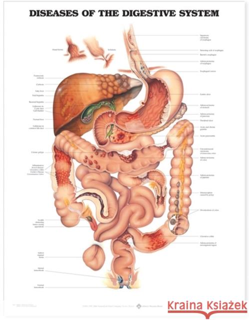 Diseases of the Digestive System Anatomical Chart  Anatomical Chart Company 9781587792373 0