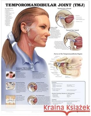 Temporomandibular Joint (TMJ) Anatomical Chart  Anatomical Chart Company 9781587792953 0