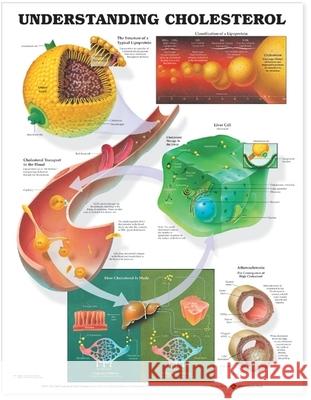 Understanding Cholesterol Anatomical Chart  9781587793264 ANATOMICAL CHART CO ,U.S.