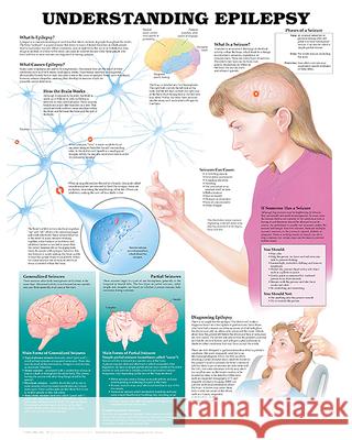 Understanding Epilepsy Anatomical Chart  9781587793356 ANATOMICAL CHART CO ,U.S.