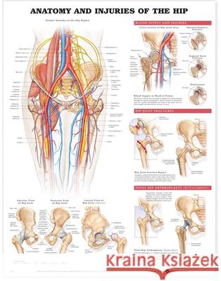 Anatomy and Injuries of the Hip Anatomical Chart  Anatomical Chart Company 9781587793820 0