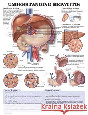 UNDERSTANDING HEPATITIS ANATOMICAL CHART  9781587794179 ANATOMICAL CHART CO ,U.S.