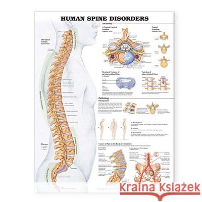 Human Spine Disorders Anatomical Chart  Anatomical Chart Company 9781587794650 0