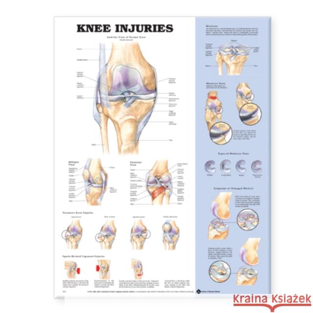 Knee Injuries Anatomical Chart  Anatomical Chart Company 9781587796968 0